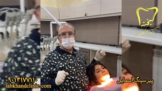 پیرسینگ اسمایل: راز لبخند جذاب‌تر