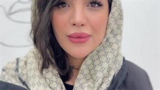 قبل و بعد بوتاکس در کلینیک نوین ایرانا