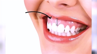 گامی اسمایل چیست؟