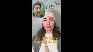 5 ماه بعد از جراحی لیفت صورت و گردن به روش دیپ پلین