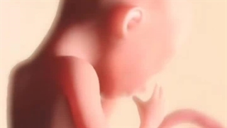 دکتر اطهر عبدالرزاق نژاد لیپوماتیک