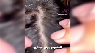 خرید و قیمت شامپو ضد ریزش رزماری بیواکوا اورجینال