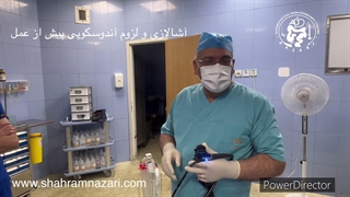 آندوسکوپی در آشالازی