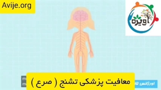 بیماری صرع در شورای پزشکی چگونه بررسی می شود