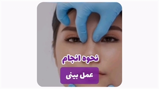 انیمیشن عمل بینی