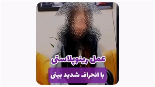 دکتر بینی در مشهد