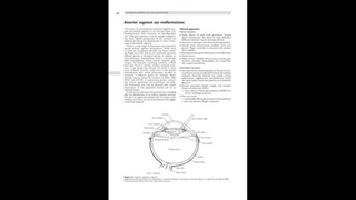 ناهنجاری‌های بخش قدامی چشم | قسمت اول | علل، تشخیص و درمان