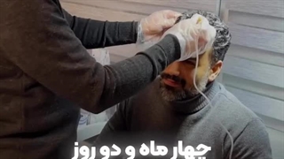 کلینیک کاشت مو vip تهران