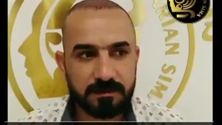 کلینیک کاشت مو آرین سیما تهران