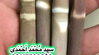 پیشانی گرگ تزریق چربی