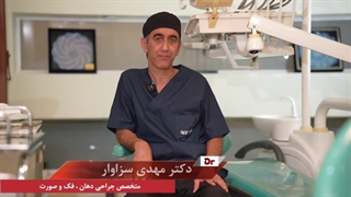 انواع روش های انجام ایمپلنت دندان