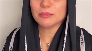 کاشت ابرو طبیعی