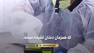 درمان 3 ریشه دندان و گذاشتن ایمپلنت دندان