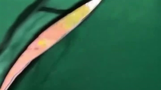 خنده بر لب میزنم تا کس نداند درد من!