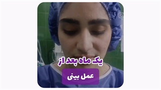 دکتر عمل بینی در مشهد