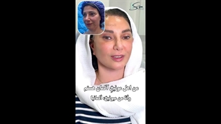 55 ساله از آلمان اومد، 30 ساله برگشت | لیفت صورت و گردن