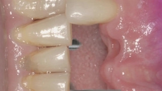 تعرفه استوری موشن تبلیغاتی دندانپزشکی | شرکت تولید محتوا اینستاگرام بیاسا