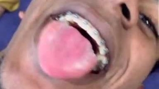 استوری کاسادو