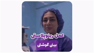 عمل بینی گوشتی در مشهد