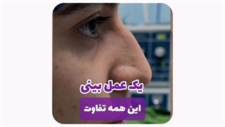 دکتر عمل بینی در مشهد