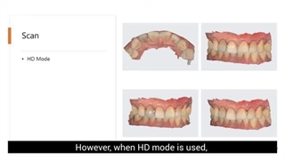 آیا می‌توان لمینت دندان را بعد از نصب، ترمیم کرد؟