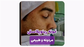 عمل بینی در مشهد