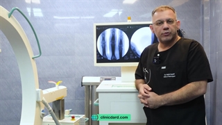 تزریق سلول بنیادی در چه شرایطی باید انجام شود  ؟