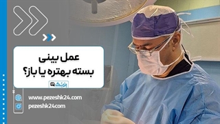 عمل بینی باز بهتره یا بسته؟ توضیحات دکتر داریوش عرفانیان | پزشک 24 کشیدن دندان