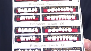 تفاوت دندون مصنوعی (1)