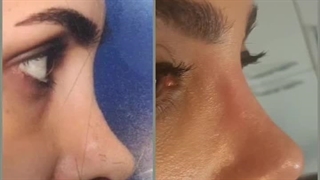 دکتر سعید راوندی لیزر موهای زائد