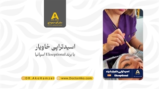 اسیدتراپی خاویار با برند Ekseptional اسپانیا در مطب دکتر آکو حمزه ای ارتودنسی