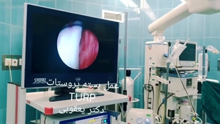 دکتر محمد یعقوبی تزریق بوتاکس