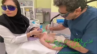 دکتر سید ناصر عمادی بلیچینگ دندان