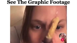 زن ۳۸ ساله ای که اعتیادش به کوکائین باعث تخریب بافت بینی اش شد