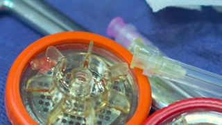 تزریق چربی با کیت‌های پیشرفته برای جوانسازی صورت در کلینیک نوین ایرانا