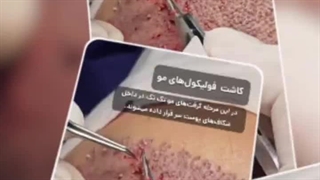 کلینیک زیبایی پرنیان