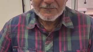 دکتر سید جواد مجتبوی جراحی زیبایی پلک