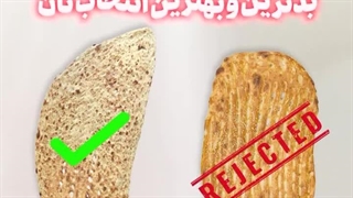 دکتر مسعود افشاری لیزر موهای زائد