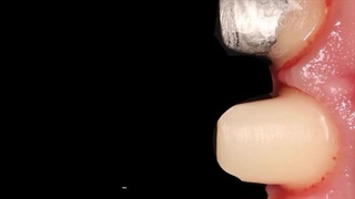 دکتر صادق پور احمدی پروتز سینه