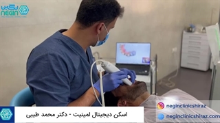 اسکن دیجیتال لمینیت دندان در کلینیک دندانپزشکی نگین شیراز
