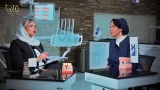 نکات مهم جایگزینی دندان از طریق ایمپلنت + پاسخ به سوالات رایج