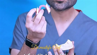 پرمصرفترین روش جایگزینی دندان