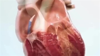 عمل ترمیم دریچه قلب با وارد کردن سیم ترانس سپتال – فرآیند و مزایا