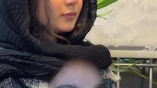 دکتر فرشته عبدالمطلبی پروتز سینه
