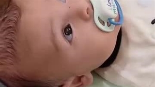 دکتر کامبیز هرمان مقدم اصلاح فرم صورت