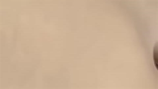 کامپوزیت دندان در لاهیجان؛ لبخندی زیبا در کوتاه‌ترین زمان! 