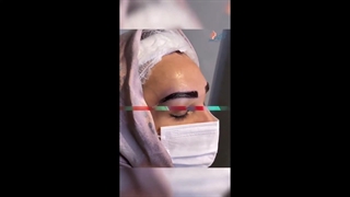 نمونه کارهای کاشت ابرو طبیعی در کلینیک آی گل