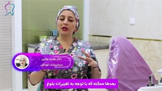 جرم گیری دندان کودکان