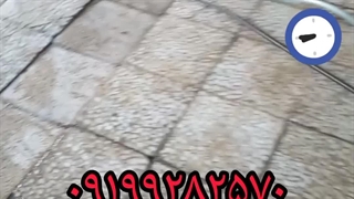 لوله بازکنی پردیس ۰۹۱۹۹۲۸۲۵۷۰ پر کردن دندان
