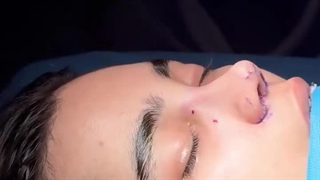 جراحی زیبایی بینی در تهران